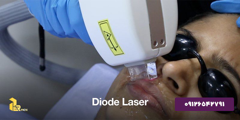 How to work a Diode Laser?
