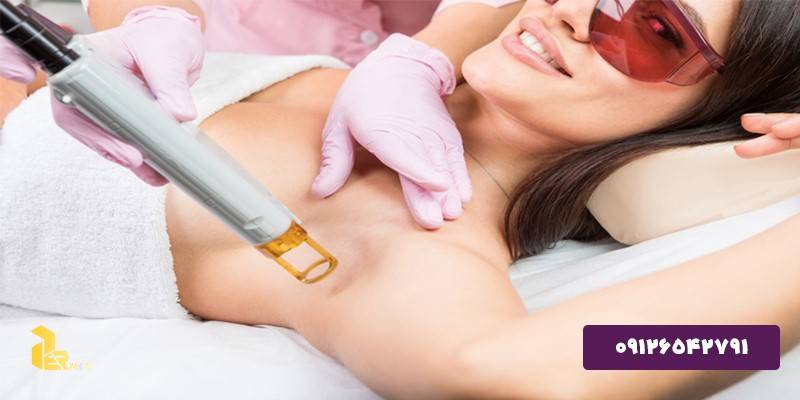 Possibility to buy laser hair removal device in installments