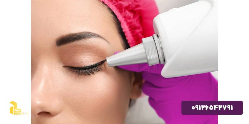 Care after laser eyebrow tattoo removal